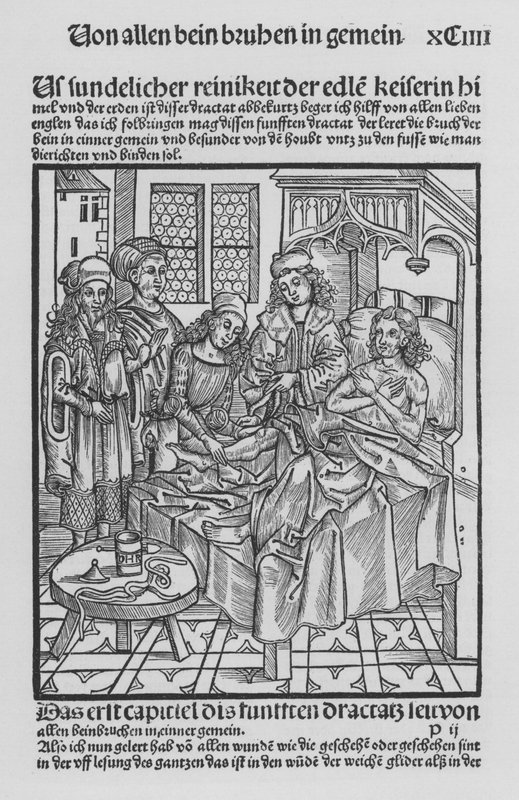 The Book of Cirurgia av Hieronymus Brunschwig (litho) av (after) German School