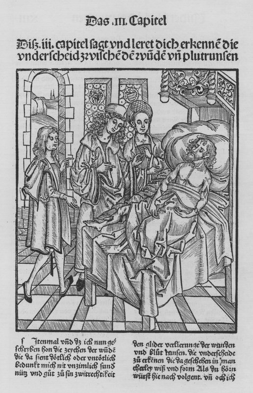 The Book of Cirurgia av Hieronymus Brunschwig (litho) av (after) German School