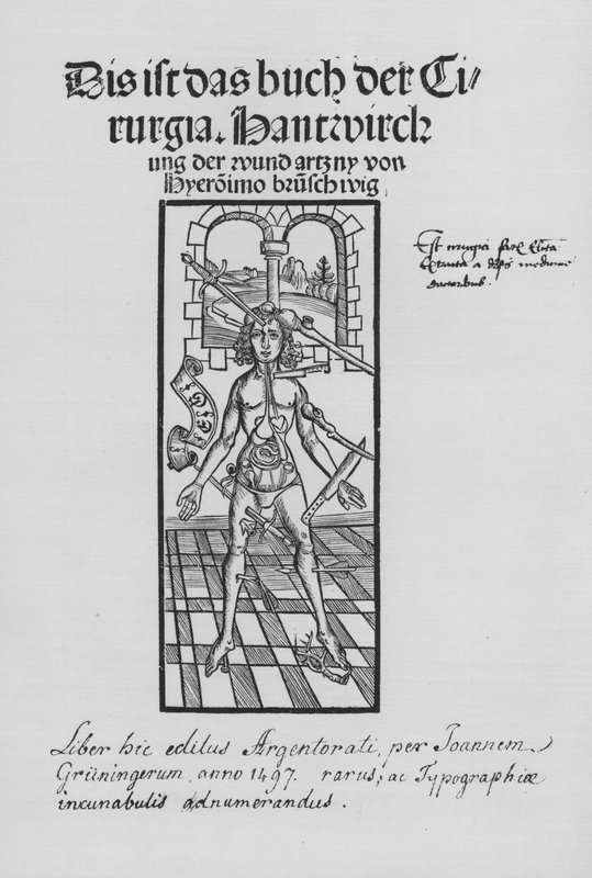 The Book of Cirurgia av Hieronymus Brunschwig (litho) av (after) German School