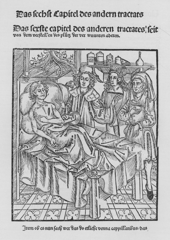 The Book of Cirurgia av Hieronymus Brunschwig (litho) av (after) German School