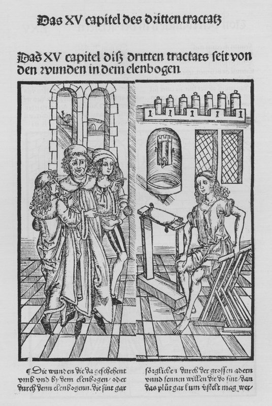 The Book of Cirurgia av Hieronymus Brunschwig (litho) av (after) German School