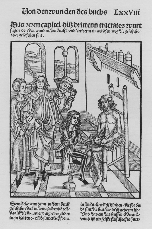 The Book of Cirurgia av Hieronymus Brunschwig (litho) av (after) German School