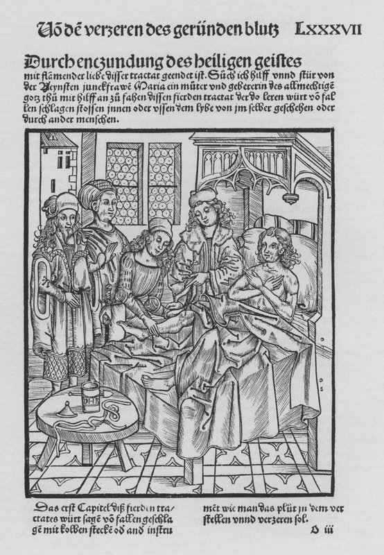 The Book of Cirurgia av Hieronymus Brunschwig (litho) av (after) German School