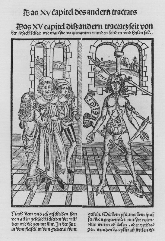 The Book of Cirurgia av Hieronymus Brunschwig (litho) av (after) German School