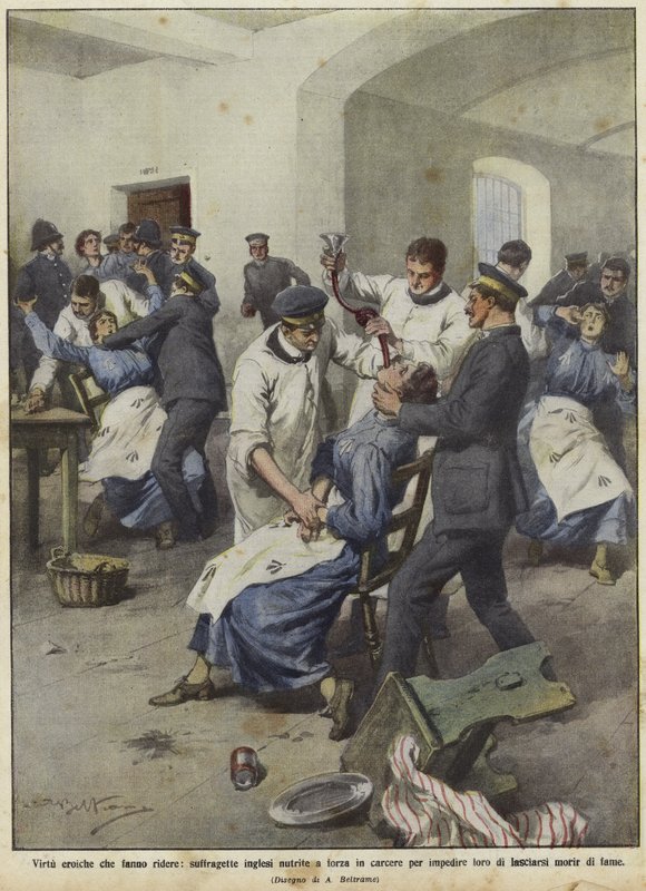 Britiske suffragetter blir tvangsmatet i fengsler av Achille Beltrame