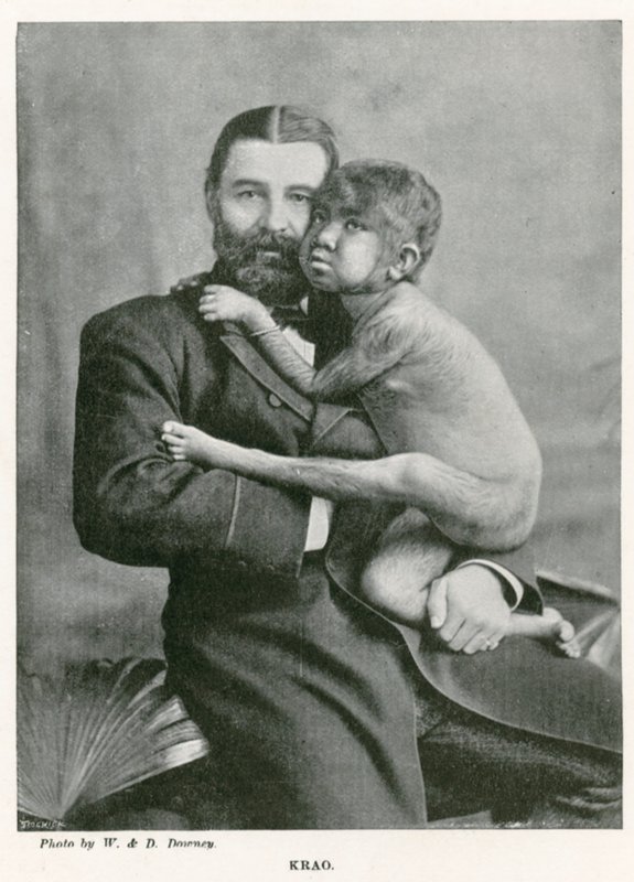 Krao, The Missing Link, utstilt på Aquarium, Westminster, London, i 1887 av English Photographer