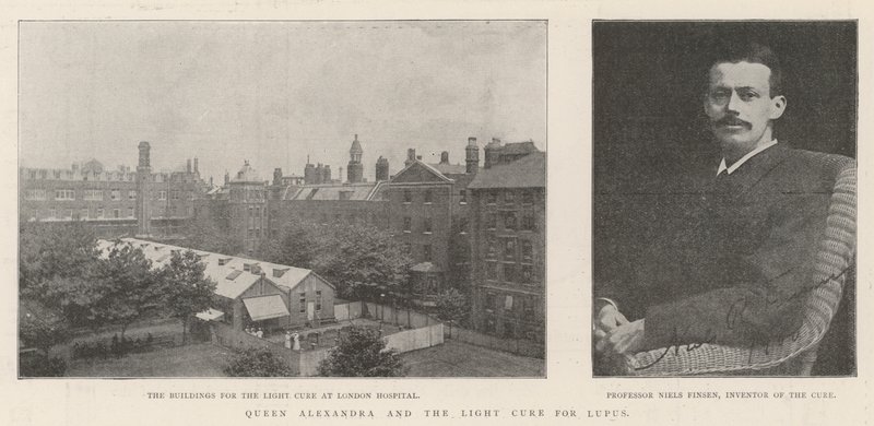 Dronning Alexandra og lyskuren for lupus av English Photographer