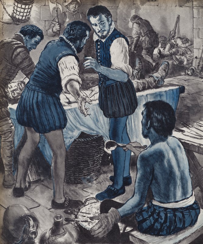 Ambroise Pare, militærkirurg, da oljen gikk tom (litho) av English School