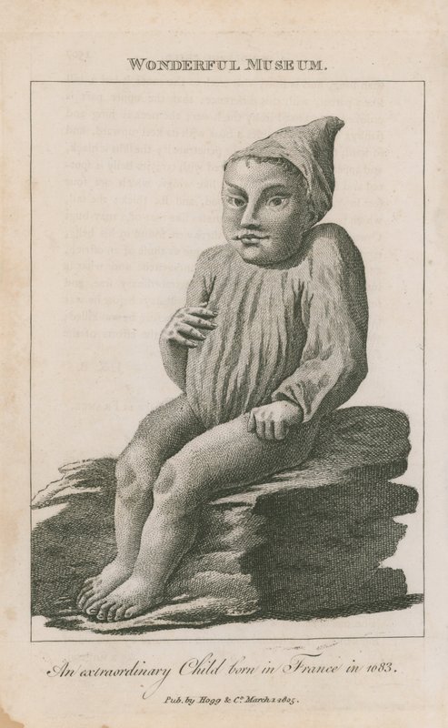 Et ekstraordinært barn født i Frankrike i 1683 av English School