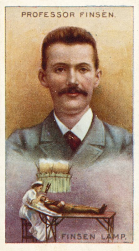 Professor Finsen, Finsen Lampe av English School