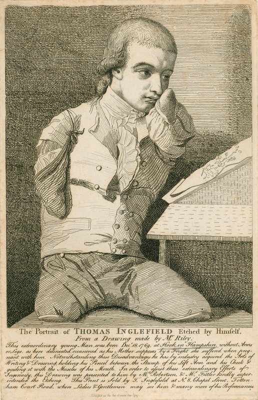 Thomas Inglefield, født 18. desember 1769 i Hook, Hampshire, uten armer eller ben av English School