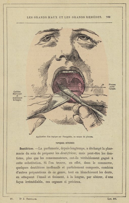 Påføring av et aktuellt stoff på mandlen ved hjelp av børsten (farge litho) av French School