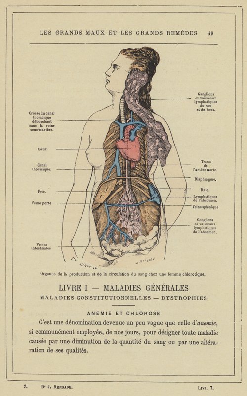 Organer for blodproduksjon og sirkulasjon hos en klorotisk kvinne (farge litho) av French School