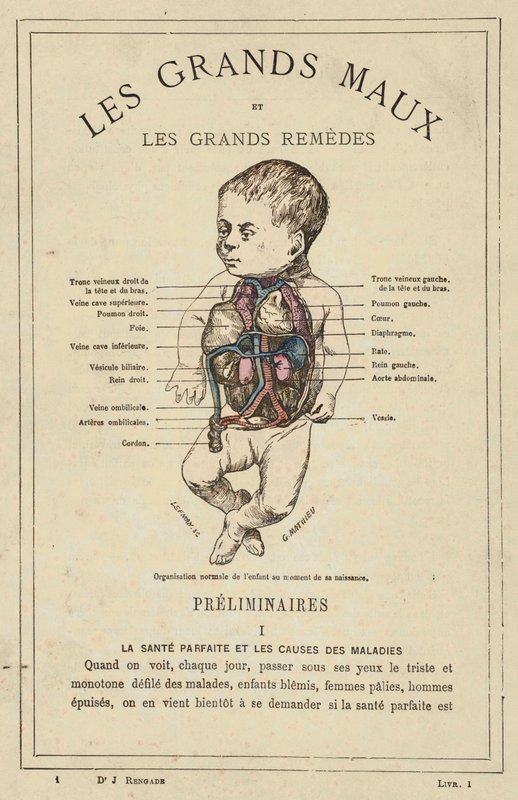 Normal organisering av barnet ved fødselen (farge litho) av French School
