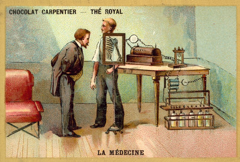 Pasient som har røntgen (chromolitho) av French School