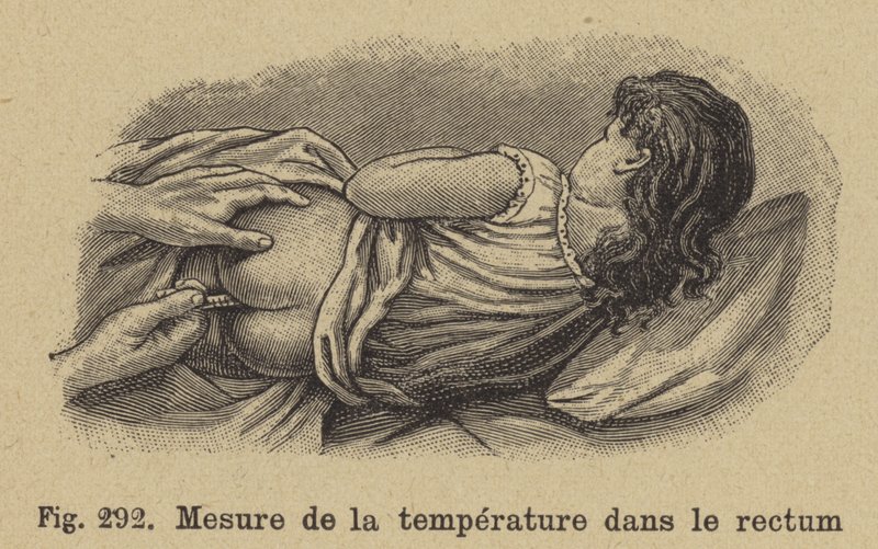 Tar et barns temperatur fra endetarmen av German School