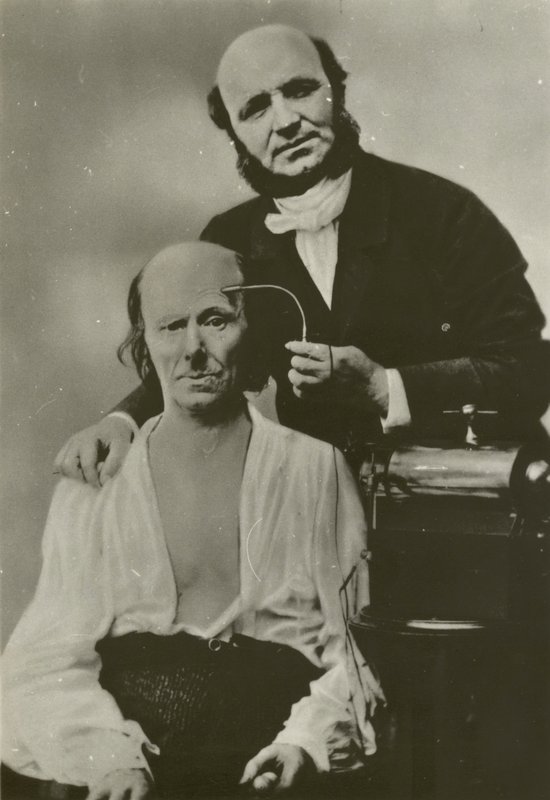Den franske nevrologen Duchenne de Boulogne bruker sitt elektrofysiologiske apparat på en gammel mann av Guillaume Benjamin Armand Duchenne de Boulogne