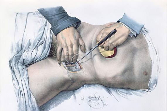 Nicolas Henri Jacob