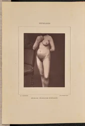 Generalisert vesikulær syfilis