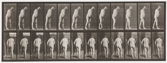 Plate 547.Hemiplegi; Walking with Crutch, 1885