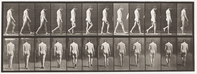 Plate 549.Epilepsi; Gående, 1885