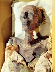 Mumifisert kropp av Ramesses II (1304–1237 f.Kr.) funnet i en grav ved Deir al-Bahri