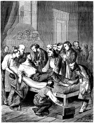 Første kirurgiske inngrep med svovelsyre-eterbedøvelse ved Boston Hospital, utført 16. oktober