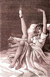 Hysteri, et ekstremt mentalt fenomen, psykoser og psykoneurose.1887 (gravering)