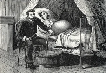 Pasient med avansert levercirrhose, lege som utfører en punktering (gravering) 1888