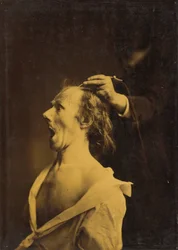 Forbauselse, lamslåelse, forbløffelse, 1854–1856, trykt 1862 (foto)