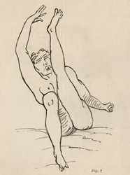 Hysterisk epilepsi, angrep, vridninger, fig. 2 fra 