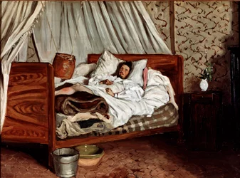 Den improviserte ambulansen (Claude Monet såret). Maleri av Jean Frédéric Bazille (1841-1870)