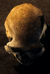Homo erectus-hodeskalle, tannløs, Dmanisi, Georgia Homo Erectus-lokalitet