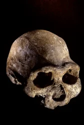 Homo erectus-hodeskalle, tannløs, Dmanisi, Georgia Homo Erectus-lokalitet