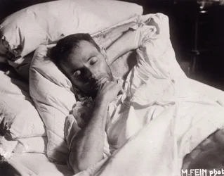 Egon Schiele på sitt dødsleie, 1918.