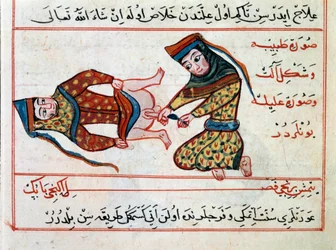 Medisin: operasjon av en hermafroditt. Miniatyr fra en avhandling om tyrkisk medisin av Sharaf al-din