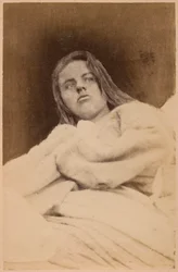 Hysterisk epilepsi, hallusinasjoner, forakt, plansje XXXI fra «Fotografisk ikonografi fra Salpêtrière» av Bourneville og P. Regnard, Paris, 1876