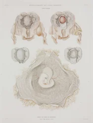 Gynekologi Menneskelig livmor med embryo, ca 1847-1859