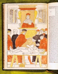 Anatomiforelesning i Padua, Italia, 1483