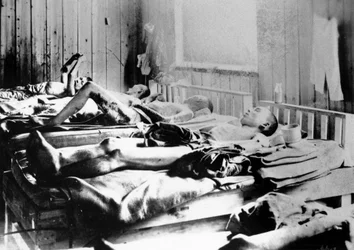 Overlevende fra eksplosjonen av atombomben i Hiroshima, Japan, 1945