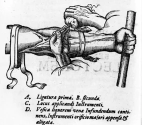 Anatomisk bord: forskjellige ligaturer. Work on the blood system av William Harvey (1578-1657), engelsk lege. Han beskrev blodsirkulasjonen i kroppen gjennom venene