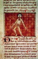 Anatomisk figur: skrell, bryst åpen. Miniatyr fra manuskriptet "" Surgery" (Folio 11v) skrevet av Henri de Mondeville (kirurg ved Philippe Le Bel professor i anatomi)