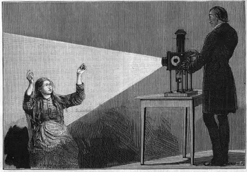 Catalepsy produced under the influence of light. French neurologist Jean Martin Charcot (1825-1893) studying the phenomene of hypnosis on a patient in Salpetriere hospital.