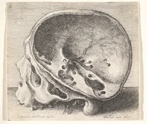 Seksjonert hodeskalle i profil til venstre med venstre side av kraniet fjernet, 1651.