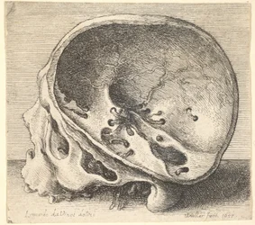 Seksjonert hodeskalle i profil til venstre med venstre side av kraniet fjernet, 1651.