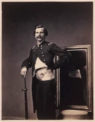 Major HA Barnum, Rehabilitering etter et penetrerende skuddsår i magen med perforasjon av venstre ilium, fra den fotografiske katalogen til den kirurgiske seksjonen.